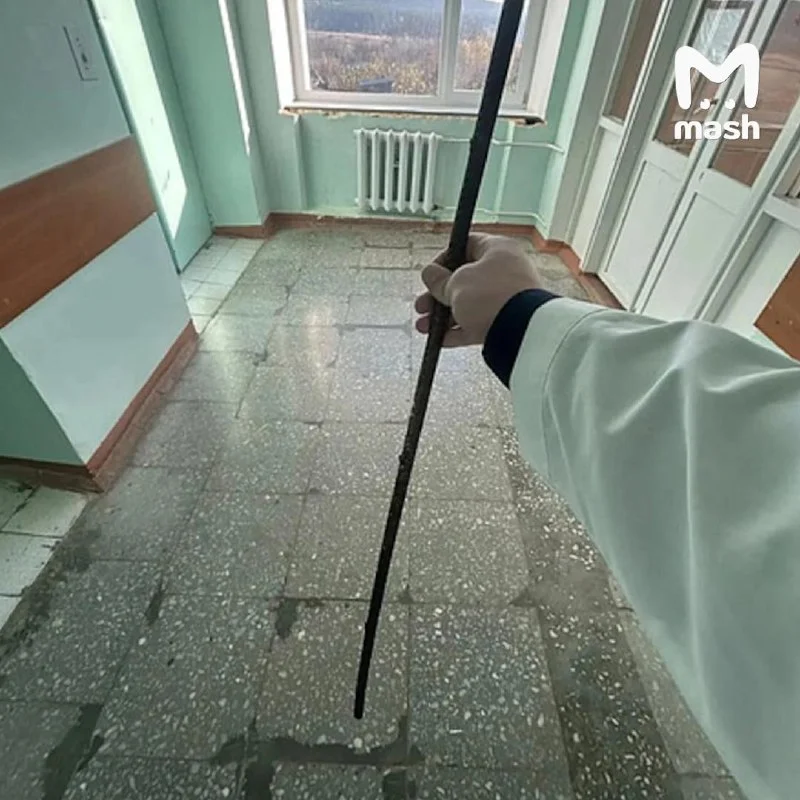 В Кировской области подросток выжил после падения на полуметровый штырь